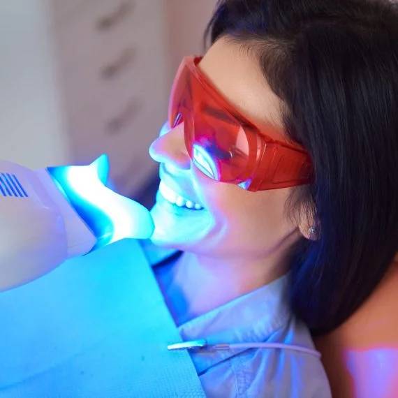 teeth whitening in Milverton